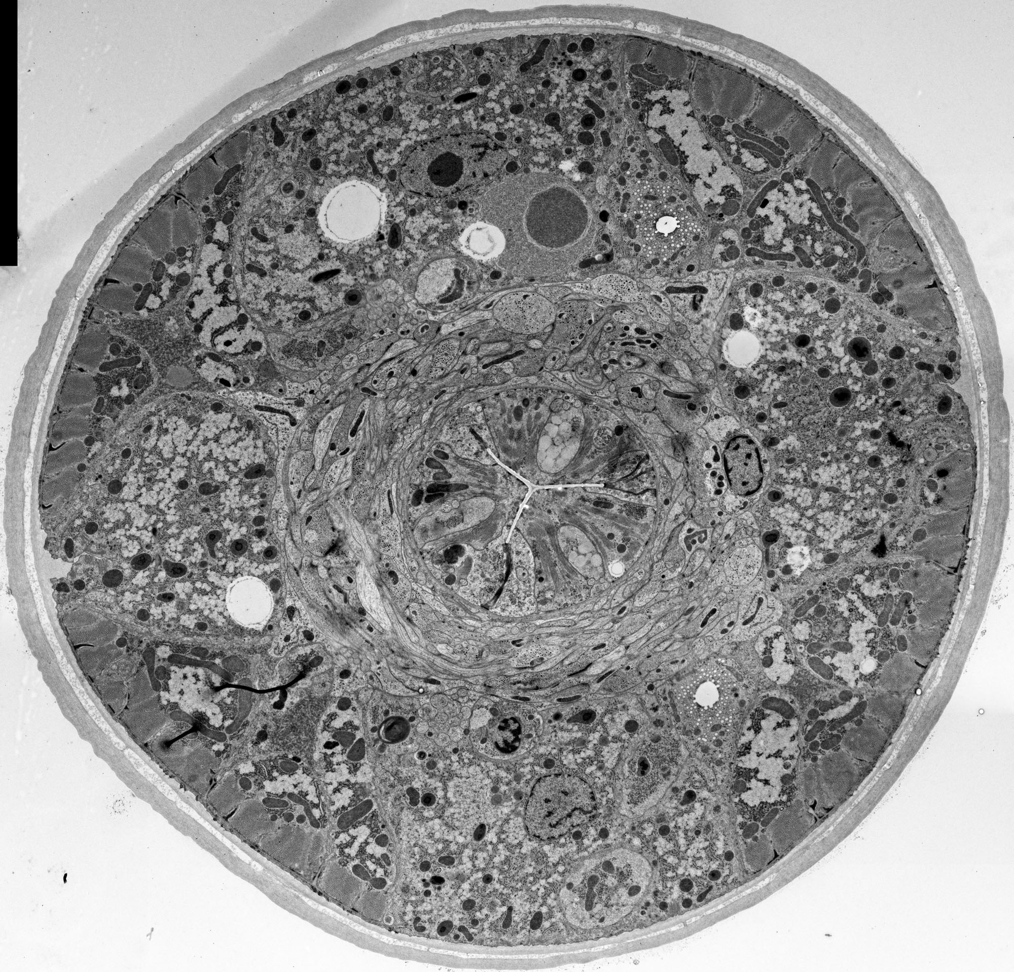 Synapse Electron Micrograph